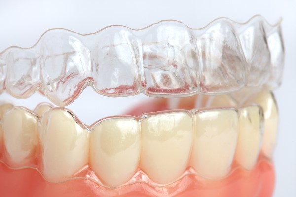 Your Role In Clear Aligners Treatments