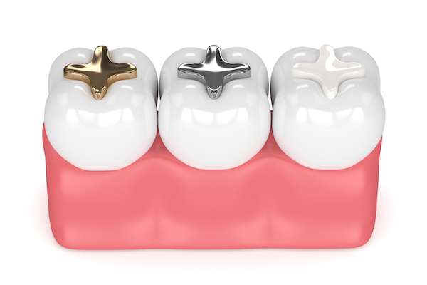 A General Dentist Discusses Different Filling Options from Vegas Smiles in Las Vegas, NV