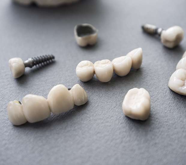 Las Vegas The Difference Between Dental Implants and Mini Dental Implants